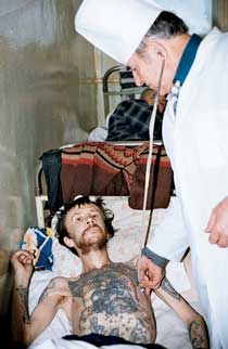 image of emaciated patient