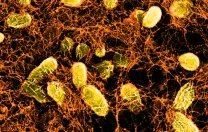A network of curli fibers (produced by genetically altered E. coli bacteria) can bind to intestinal surfaces, where it acts like a Band-Aid, and can even deliver probiotic therapies.
