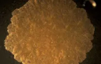 Mycobacteria form greasy, fatty-looking colonies. Their thick lipid coatings may play a role in allowing them to survive an onslught of antibiotics.