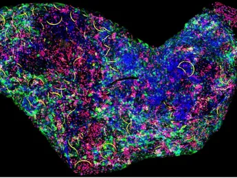 A fluorescence image of brain tissue