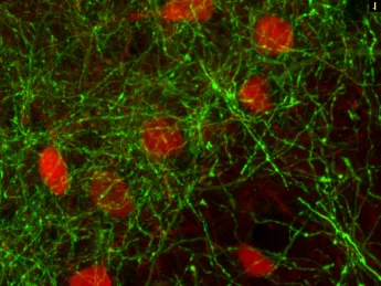 Basal forebrain GABA parvalbumin neurons play a key role in triggering the synchronized rhythms that characterize conscious thought.
