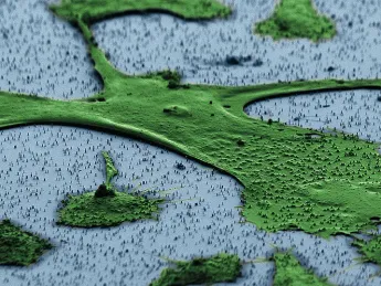 A human fibroblast—part of the body’s connective tissue—sits on a bed of vertical nanowires in this image from a scanning electron microscope. Hongkun Park and his colleagues hope that the nanowires, which penetrate the cell without harming it, can be a way to introduce genes into cells without the use of an engineered virus or invasive delivery method. One application could be adding a set of genes to fibroblasts that “reprogram” them to act like stem cells.