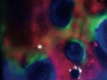 The fate of stem cells (white) in bone marrow is influenced by their immediate environment of bone cells (green), blood vessels (red), and bone (blue). Genetical­ly defective “bad neighbors” can actually cause cancer.