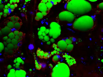 These fat cells were created from human pluripotent stem cells. Being able to create vast numbers of such cells allows scientists to test millions of drug compounds in a petri dish.