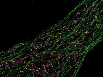 Super-resolution microscopy developed in the lab of Peng Yin allows researchers using conventional microscopes to see the inner workings of cells at the single molecule level. Above, microtubules (green) and mitochondria (purple) dominate the intracellular landscape.