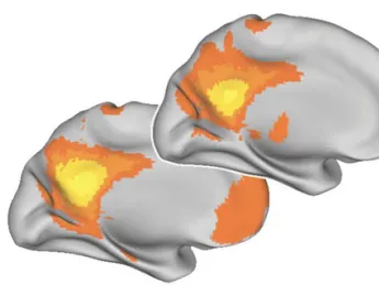 The younger brain, below, shows more synchronized activity than the older brain, above. 