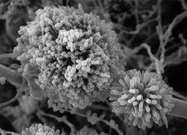 magnified detail of microorganism on stone surface