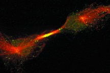 One of the proteins Tsai studies, shown in green, concentrates at the midbody of dividing cells.