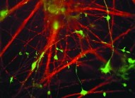 An image from the laboratory of Li-Huei Tsai shows a protein, in green, associated with growing structures in cultured young cortical neurons