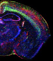 Three different variants (red, blue, and green) of Class I MHC molecules in an adult mouse brain. New technology helps researchers trace the complexities of brain function far beyond the single-cell studies of the recent past.