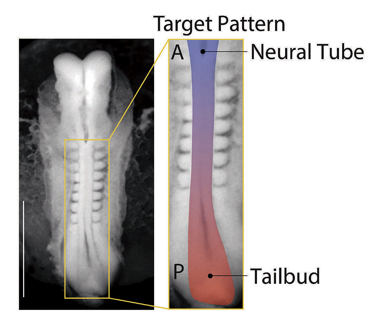 Inset of an image from the Kyoto Collection of Human Embryos and Fetuses in Japan shows the developmental pattern that the Ramanathan lab set out to mimic. Specifically, they aimed to induce a sphere of pluripotent stem cells to form an anterior (A) to posterior (P) axis, a critical early stage in mammalian embryonic development.     |   IMAGE COURTESY OF SHARAD RAMANATHAN