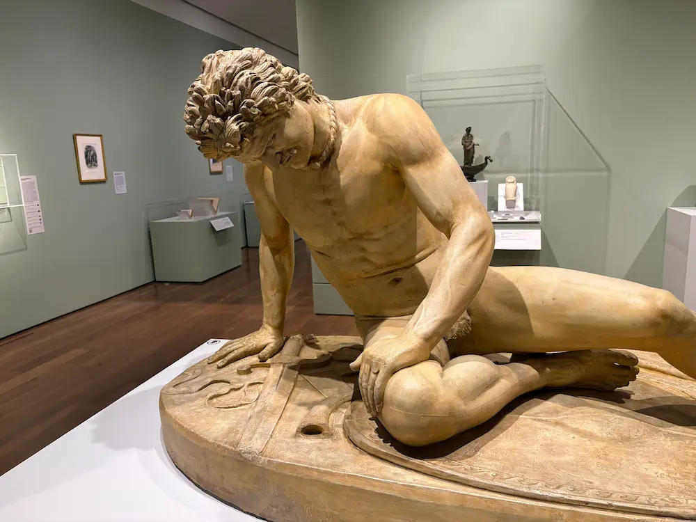A sculpture of a man clutching his leg in pain, having just been wounded