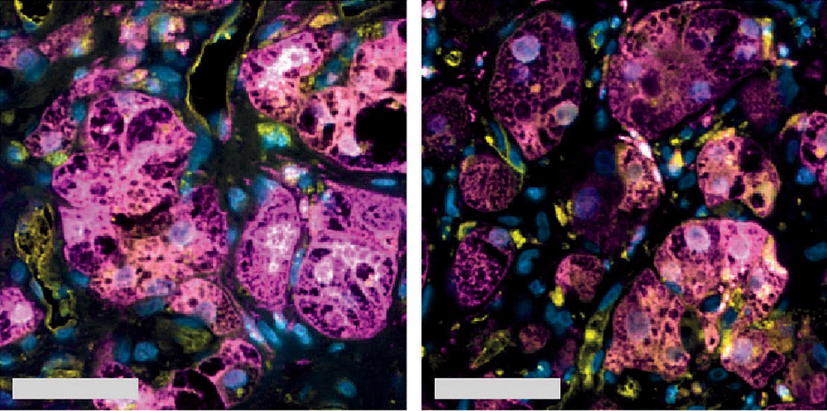 Photographs of liver tissue, purple blobs with yellow and blue spots