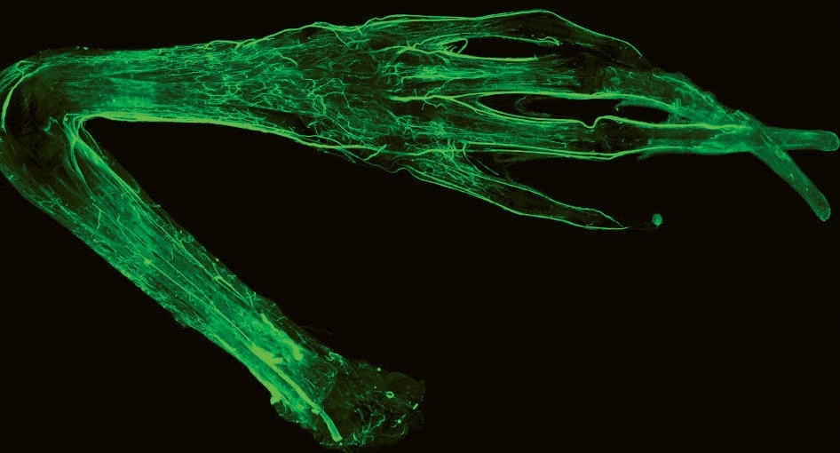 Fluorescent-stained nerve fibers in a dissected mouse forelimb against a black background.