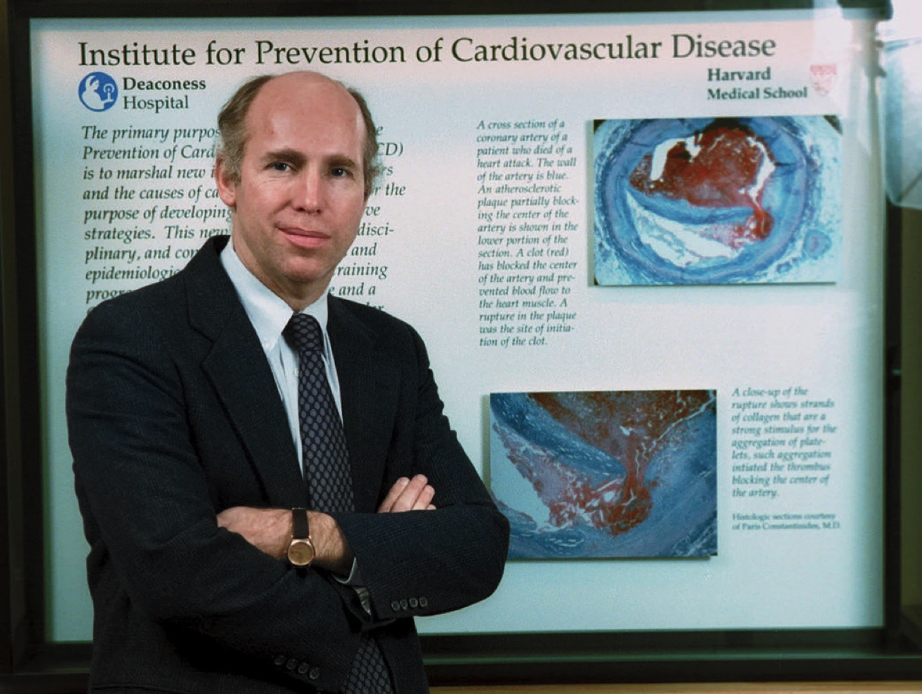 James Muller in suit stands arms crossed before cardiovascular disease display.