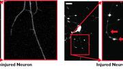 A comparison of healthy and injured neurons, from research by the Parker team. Injured neurons show localized swellings, as indicated by red arrows in the magnified image at far right.