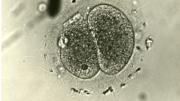 Rock, Hertig, and laboratory assistant Miriam Menkin conducted the first successful in vitro fertilization in 1944; this image shows the fertilized ovum from that experiment. (Research on in vitro fertilization was banned for a time in the United States; the first in vitro baby, Louise Brown, was born in England in 1978.)