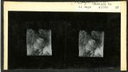 Rock and his Harvard Medical School colleague Arthur Hertig filled in gaps in knowledge about human reproduction by documenting the first 17 days after fertilization, using 34 fertilized ova removed from patients who were undergoing hysterectomies and consented to inclusion in this research. This stereopticon card from 1938 shows an embryo 11 days after fertilization.