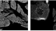"White sparkles," as Melton calls them, indicate beta cell proliferation in this cross section of a pancreas from a betatrophin-treated mouse.