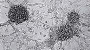 Traditional light-microscopy, such as this image of human brain-tumor cells in culture, still has a place in cancer research. 