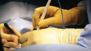Gawande’s hands are at right in this photograph from the operating room.