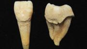 Two teeth from a man who lived 3,200 years ago, the plaque on which shows that his diet included sheep and goat milk.