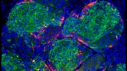 The image shows human-stem-cell-derived beta cells that have formed islet-like clusters in a mouse. The cells were transplanted to the kidney capsule (the fibrous connective layer surrounding the kidneys); the photograph was taken two weeks later, by which time the beta cells were making insulin and had cured the diabetes in the mouse.