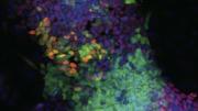 An induced pluripotent stem-cell colony produced in part by using a drug—a new, safer technique.