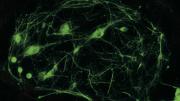 Motor neurons produced from reprogrammed cells enable researchers to study ALS in a petri dish.