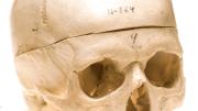 Human <i>(H. sapiens)</i>