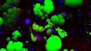 These fat cells were created from human pluripotent stem cells. Being able to create vast numbers of such cells allows scientists to test millions of drug compounds in a petri dish.