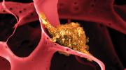 Image shows a dendritic cell (shown in yellow) attached to a man-made polymer lattice inside a pill-sized implantable device.