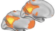 The younger brain, below, shows more synchronized activity than the older brain, above. 