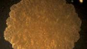 Mycobacteria form greasy, fatty-looking colonies. Their thick lipid coatings may play a role in allowing them to survive an onslught of antibiotics.
