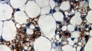 This image shows small brown-fat cells&mdash;which burn energy as heat&mdash;interspersed among larger white-fat cells, which store energy. The former are stained brown here; their natural color, which results from the density of mitochondria, would not be visible in this thin cross-section of tissue. (The blue staining marks cell nuclei.)