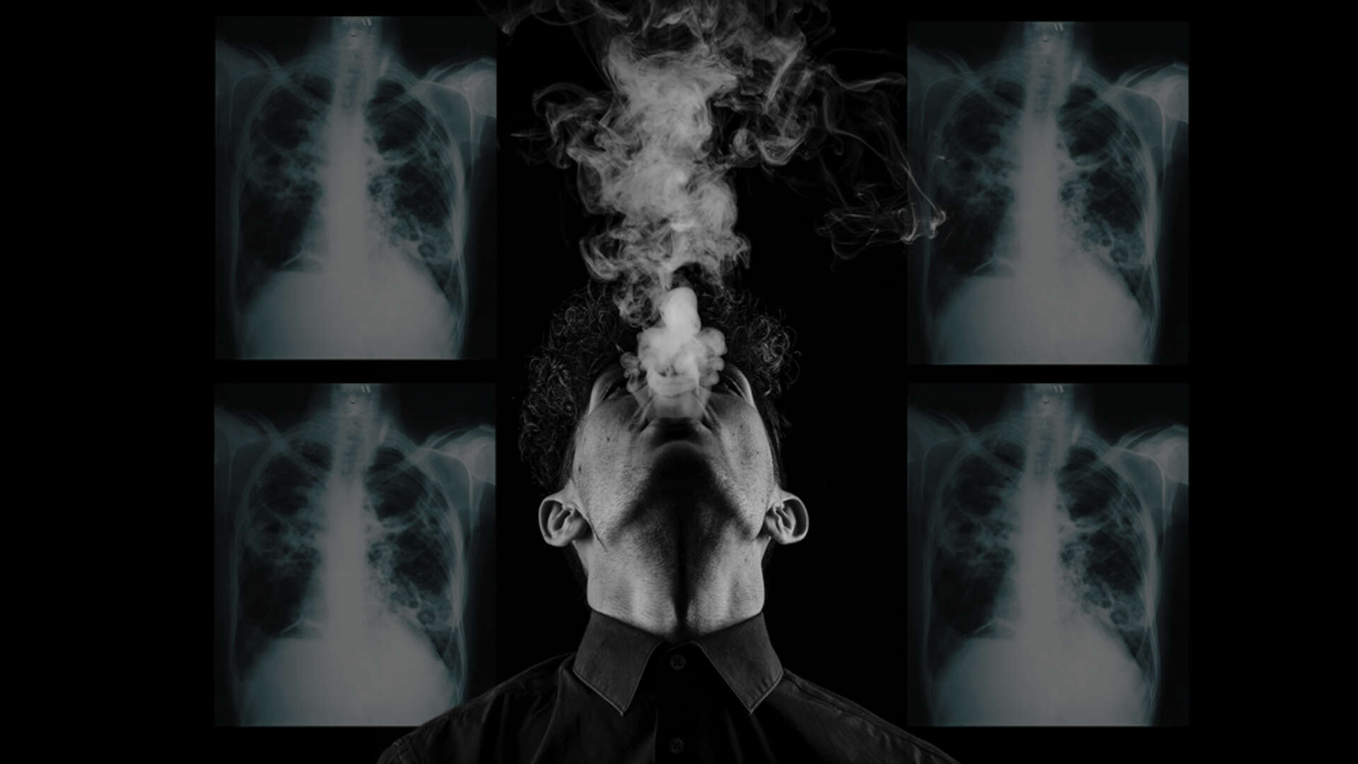 tuberculosis cigarette smoking Tobacco is hazardous to your #lungs. It increases the risk of # tuberculosis, #COPD, respiratory infections, lung cancer and makes asthma symptoms harder to control. #TobaccoKills #WorldLungDay https://upmc.me/2ns80w5 Exposure-Response Relationships Between Tobacco Smoking