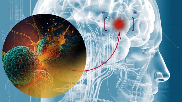 Illustration of a translucent human head showing the brain within, with an exploded view of a cancer cell killing another cancer cell within the brain.
