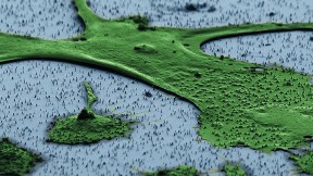A human fibroblast—part of the body’s connective tissue—sits on a bed of vertical nanowires in this image from a scanning electron microscope. Hongkun Park and his colleagues hope that the nanowires, which penetrate the cell without harming it, can be a way to introduce genes into cells without the use of an engineered virus or invasive delivery method. One application could be adding a set of genes to fibroblasts that “reprogram” them to act like stem cells.