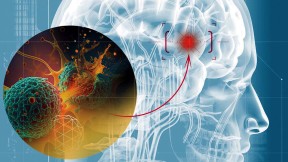 Illustration of a translucent human head showing the brain within, with an exploded view of a cancer cell killing another cancer cell within the brain.