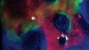 The fate of stem cells (white) in bone marrow is influenced by their immediate environment of bone cells (green), blood vessels (red), and bone (blue). Genetical­ly defective “bad neighbors” can actually cause cancer.