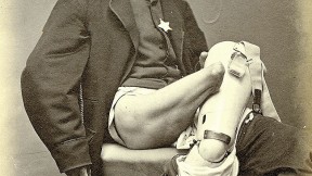 Civil War amputee Charles T. Green, photographed by William Bell (circa 1864)