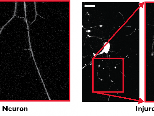 A comparison of healthy and injured neurons, from research by the Parker team. Injured neurons show localized swellings, as indicated by red arrows in the magnified image at far right.