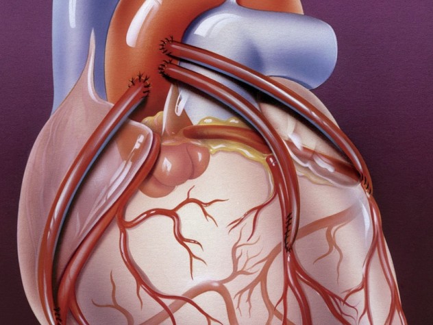 Image by John Bavosi/Science Source Three bypass arteries connect the aorta to smaller coronary arteries on the heart’s outer surface.