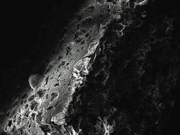 A scanning electron microscope image reveals the porous nature of a bioengineered disk where immune cells can reside and be programmed for vaccination.