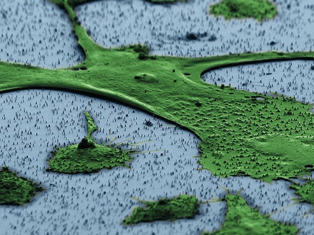 A human fibroblast—part of the body’s connective tissue—sits on a bed of vertical nanowires in this image from a scanning electron microscope. Hongkun Park and his colleagues hope that the nanowires, which penetrate the cell without harming it, can be a way to introduce genes into cells without the use of an engineered virus or invasive delivery method. One application could be adding a set of genes to fibroblasts that “reprogram” them to act like stem cells.