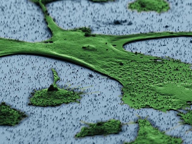 Image courtesy of Jacob Robinson, Alex Shalek, and Hongkun Park A human fibroblast—part of the body’s connective tissue—sits on a bed of vertical nanowires in this image from a scanning electron microscope. Hongkun Park and his colleagues hope that the nanowires, which penetrate the cell without harming it, can be a way to introduce genes into cells without the use of an engineered virus or invasive delivery method. One application could be adding a set of genes to fibroblasts that “reprogram” them to act like stem cells.