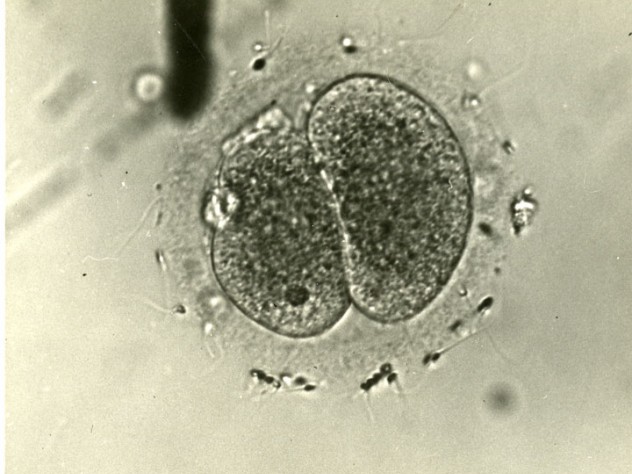 Courtesy of the Harvard Medical Library in the Francis A. Countway Library of Medicine Rock, Hertig, and laboratory assistant Miriam Menkin conducted the first successful in vitro fertilization in 1944; this image shows the fertilized ovum from that experiment. (Research on in vitro fertilization was banned for a time in the United States; the first in vitro baby, Louise Brown, was born in England in 1978.)