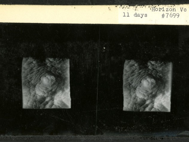 Courtesy of the Harvard Medical Library in the Francis A. Countway Library of Medicine Rock and his Harvard Medical School colleague Arthur Hertig filled in gaps in knowledge about human reproduction by documenting the first 17 days after fertilization, using 34 fertilized ova removed from patients who were undergoing hysterectomies and consented to inclusion in this research. This stereopticon card from 1938 shows an embryo 11 days after fertilization.
