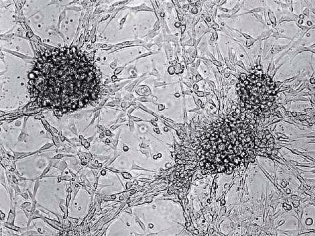Virtual Tumors | Harvard Magazine