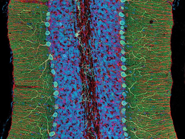 Courtesy of Thomas Deerinck and Mark Ellisman (2004) A photomicrograph showing different components of the rat cerebellum, including Purkinje neurons in green, glia (nonneuronal cells) in red, and cell nuclei in blue.
